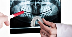 Mouth Guard Fitting in Park City Utah